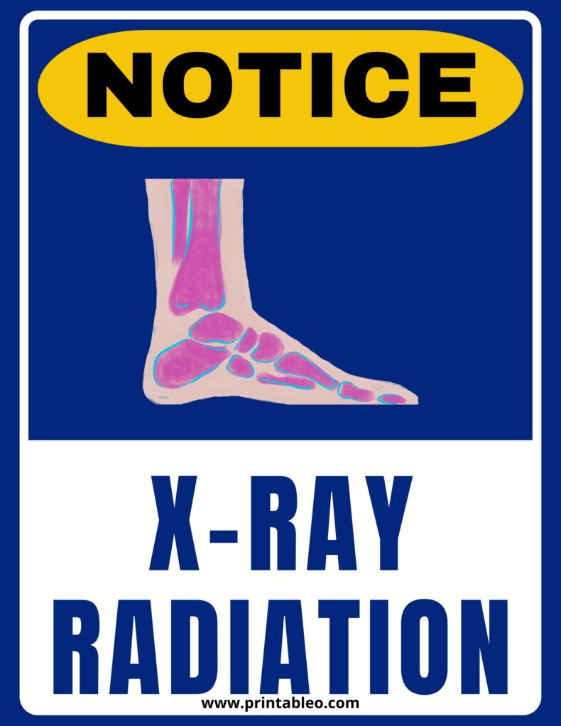 X Ray Radiation Sign PDF
