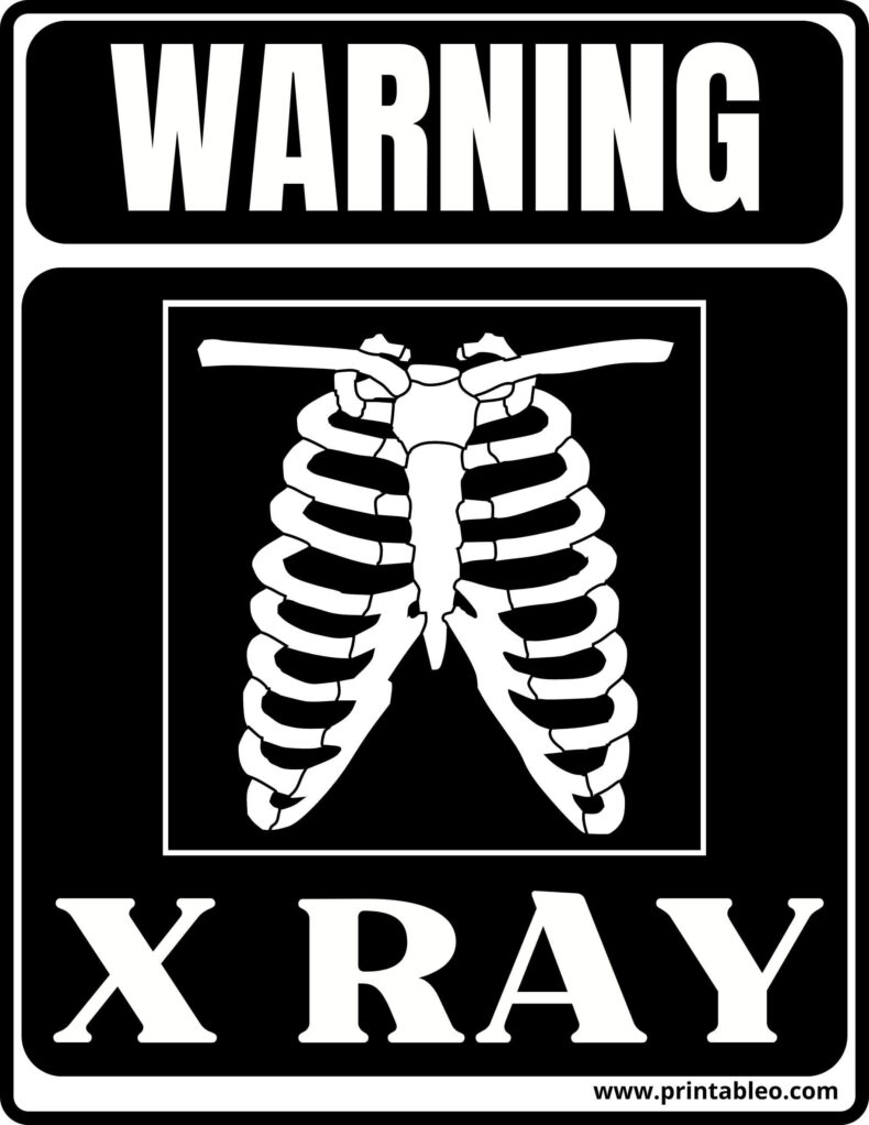 Printable X Ray Sign