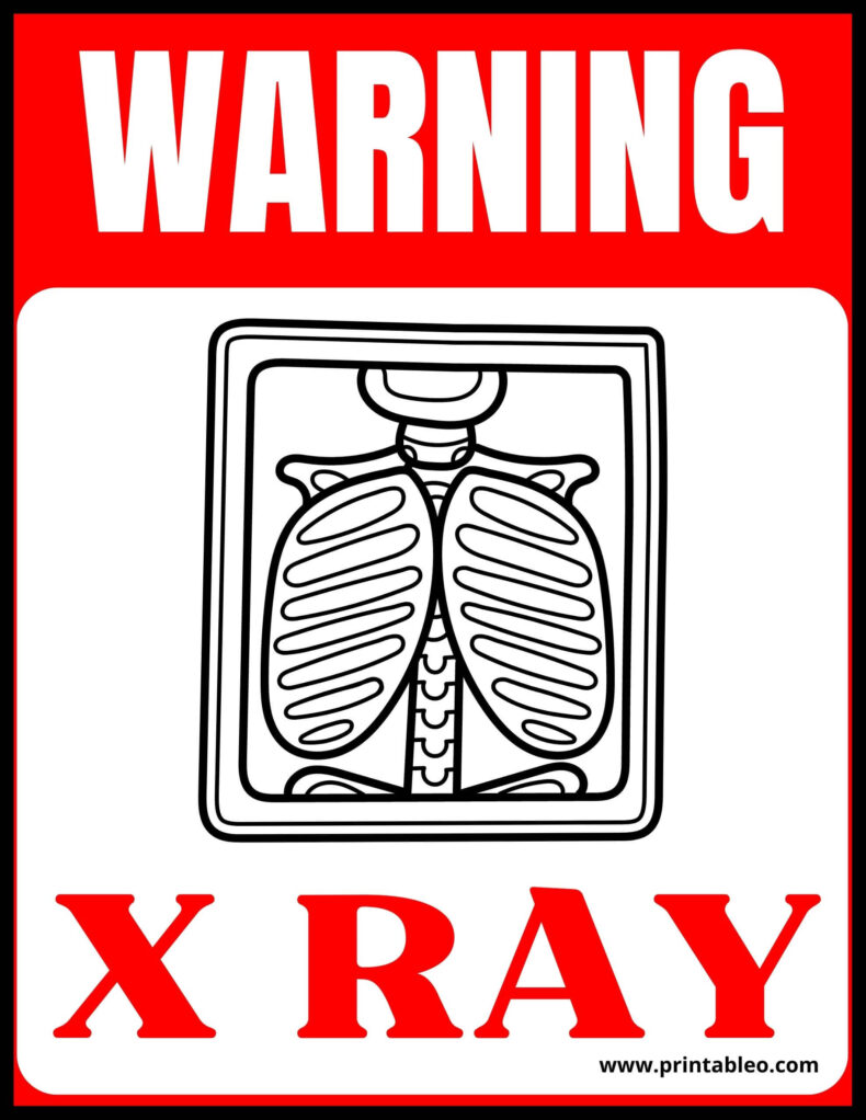 X Ray Warning Sign
