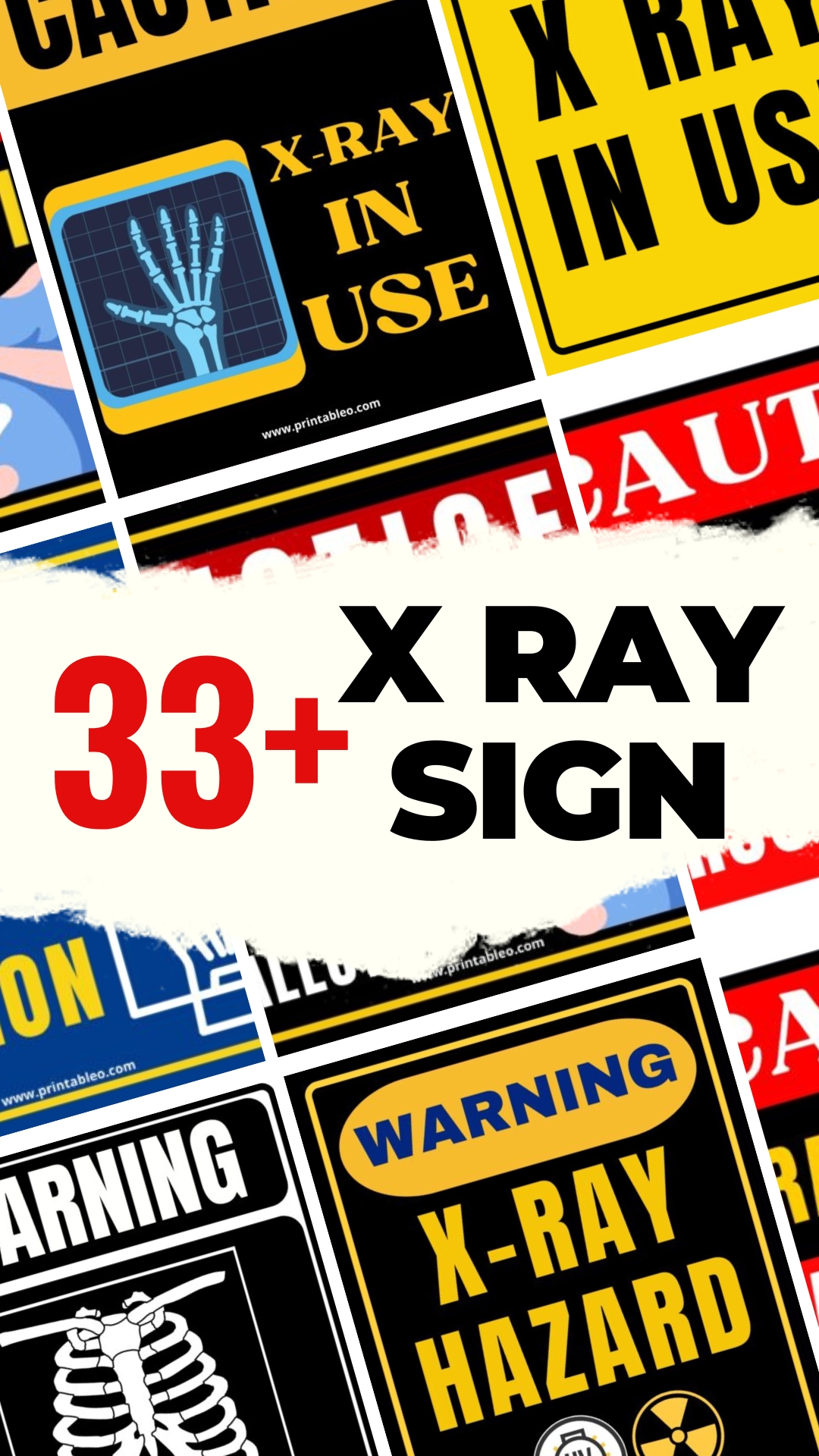 33+ X RAY SIGN