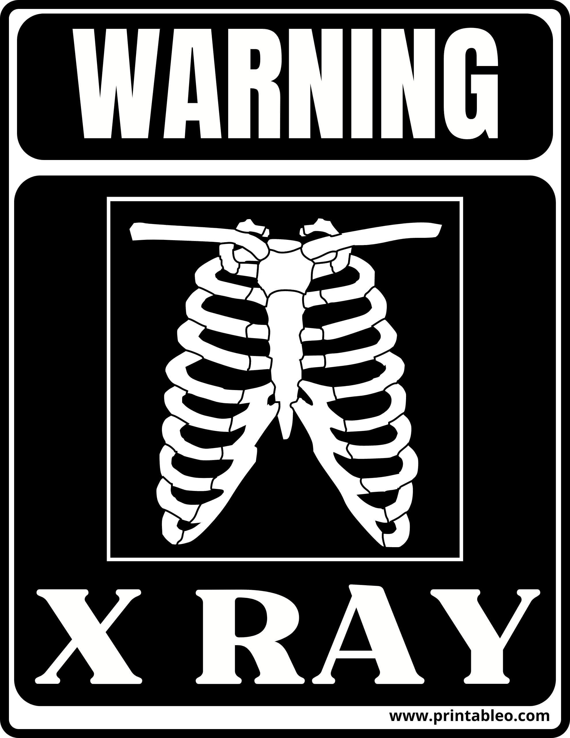 33+ Printable XRay Sign FREE PDF